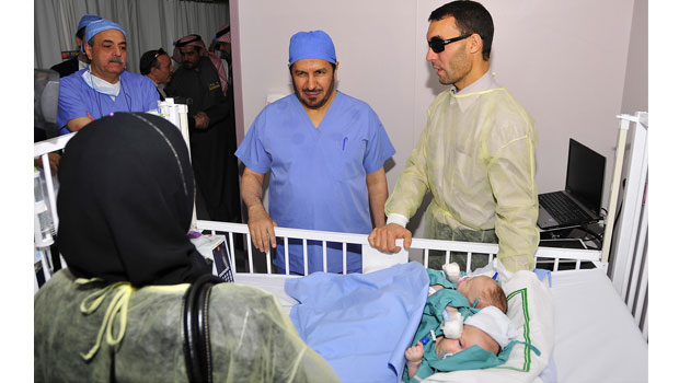 Algerian conjoined twins separated at Riyadh hospital