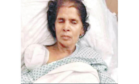 Indian maid who lost her right arm repatriated